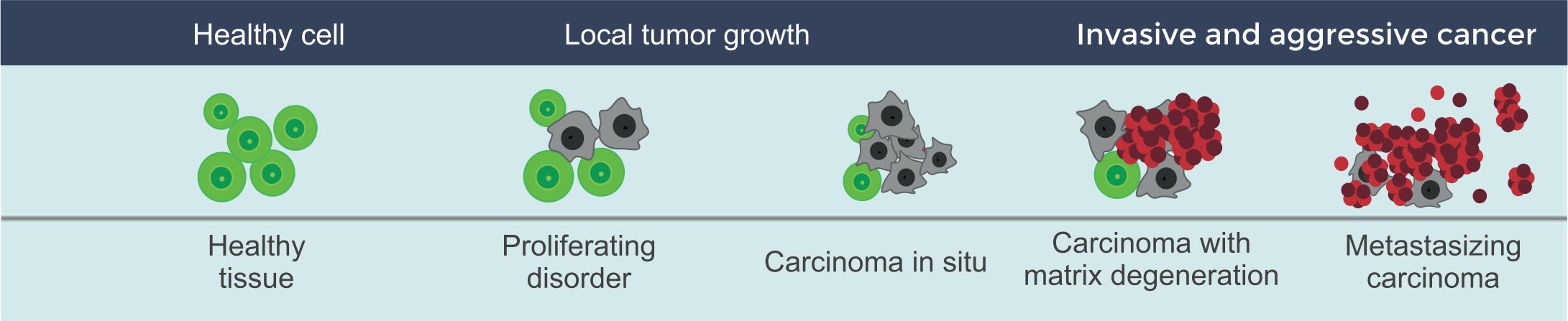 https://www.medidect.com/wp-content/uploads/2024/06/Tumor-Development.png
